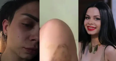 «Երեկ ծեծված էր, այսօր արդեն պարում է». բռնությունն ունի այս տեսքը, ապրելու ցանկությունն ունի այս տեսքը. Մարի Պետրոսյանն անկեղծ գրառում է կատարել