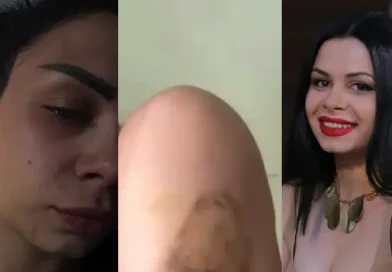 «Երեկ ծեծված էր, այսօր արդեն պարում է». բռնությունն ունի այս տեսքը, ապրելու ցանկությունն ունի այս տեսքը. Մարի Պետրոսյանն անկեղծ գրառում է կատարել