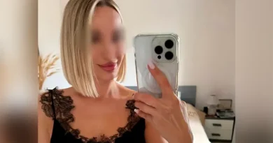 Բլոգերը մահացել է հետույքի մեծացման վիրահատությունից հետո